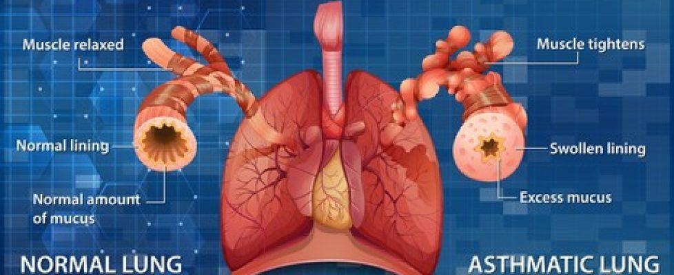 human-anatomy-asthma-diagram-illustration-260nw-1862260579